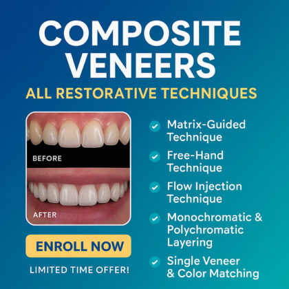 Composite Veneers: All Restorative Techniques